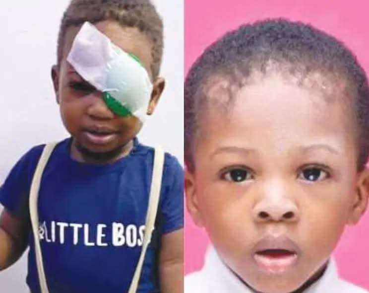 Parents of slain toddler seek compensation as survivor brother, 4, loses eye